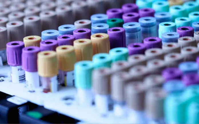 Deteção e controlo no trabalho do consumo de álcool e drogas